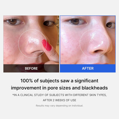 Zero Pore Pad 2.0