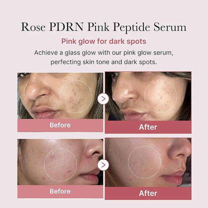 Pink Glow Serum