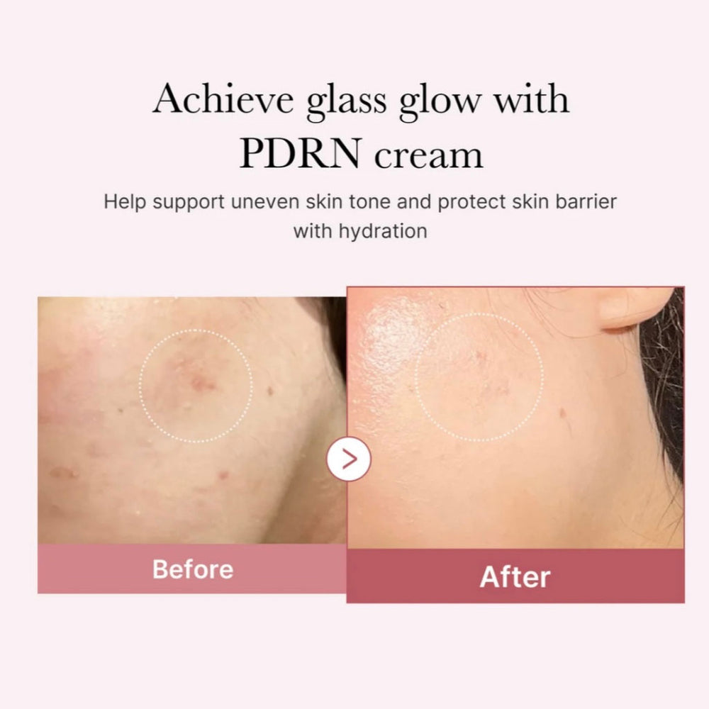 PDRN Pink Hyaluronic Moisturizing Cream